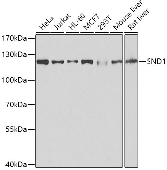 WB analysis of various sample lysates using GTX33508 SND1 antibody. Dilution : 1:1000 Loading : 25microg per lane