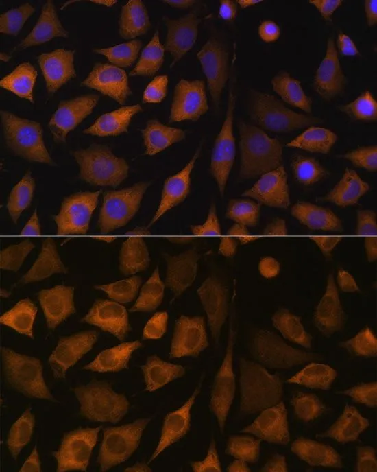 ICC/IF analysis of L929 cells using GTX33508 SND1 antibody. Blue : DAPI Dilution : 1:100