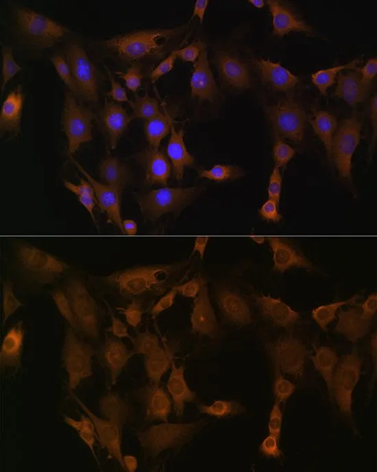 ICC/IF analysis of C6 cells using GTX33508 SND1 antibody. Blue : DAPI Dilution : 1:100