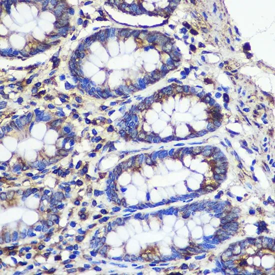 IHC-P analysis of human colon tissue using GTX33508 SND1 antibody. Dilution : 1:100