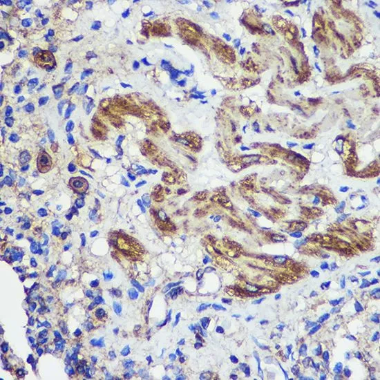 IHC-P analysis of rat lung tissue using GTX33508 SND1 antibody. Dilution : 1:100