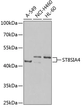 WB analysis of various sample lysates using GTX33523 ST8SIA4 antibody. The signal was developed with ECL plus-Enhanced. Dilution : 1:1000 Loading : 25microg per lane WB analysis of various sample lysates using GTX33523 ST8SIA4 antibody. The signal was developed with ECL plus-Enhanced. Dilution : 1:1000 Loading : 25microg per lane