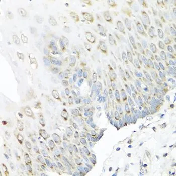 IHC-P analysis of human esophagus tissue using GTX33527 Staufen antibody. Dilution : 1:100