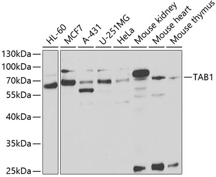WB analysis of various sample lysates using GTX33533 TAB1 antibody. Dilution : 1:1000 Loading : 25microg per lane