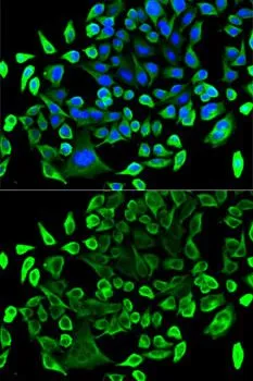 ICC/IF analysis of U2OS cells using GTX33533 TAB1 antibody. Blue : DAPI