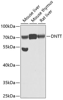 WB analysis of various samples using GTX33539 TdT antibody. Dilution : 1:1000 Loading : 25ug per lane