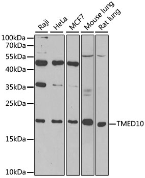 IHC-P analysis of mouse brain tissue using GTX33548 TMP21 antibody. Dilution : 1:100