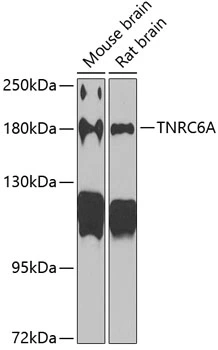 WB analysis of various sample lysates using GTX33551 TNRC6A antibody. Dilution : 1:1000 Loading : 25microg per lane WB analysis of various sample lysates using GTX33551 TNRC6A antibody. Dilution : 1:1000 Loading : 25microg per lane