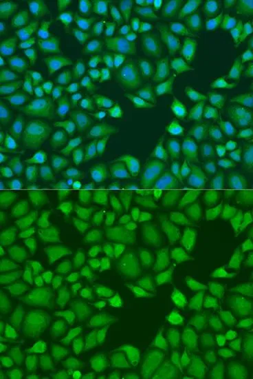 ICC/IF analysis of U2OS cells using GTX33551 TNRC6A antibody. Blue : DAPI Dilution : 1:100