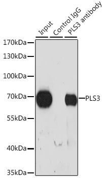 IP analysis of HeLa cell lysate using GTX33552 T-Plastin antibody. Antibody amount : 3microg / 200microg lysate Dilution : 1:1000 IP analysis of HeLa cell lysate using GTX33552 T-Plastin antibody. Antibody amount : 3microg / 200microg lysate Dilution : 1:1000