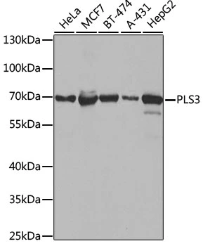 WB analysis of various sample lysates using GTX33552 T-Plastin antibody. Dilution : 1:1000 Loading : 25microg per lane