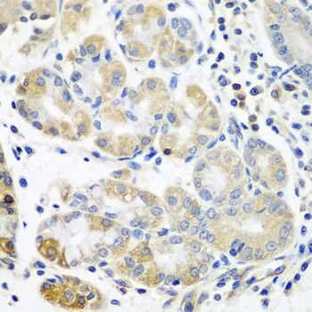 IHC-P analysis of human stomach tissue using GTX33552 T-Plastin antibody. Dilution : 1:100