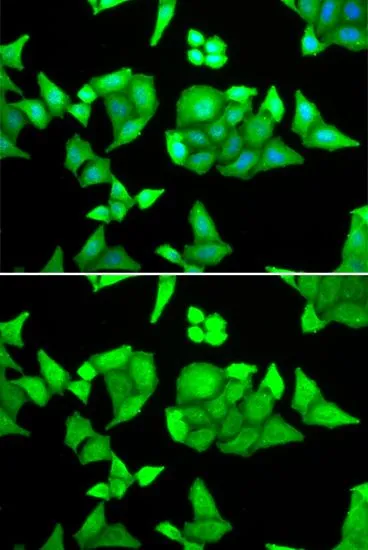 ICC/IF analysis of U2OS cells using GTX33559 TRIM27 antibody. Blue : DAPI
