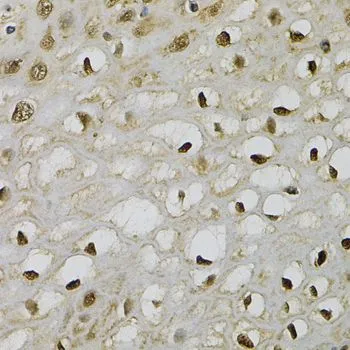 IHC-P analysis of human esophagus tissue using GTX33559 TRIM27 antibody. Dilution : 1:100