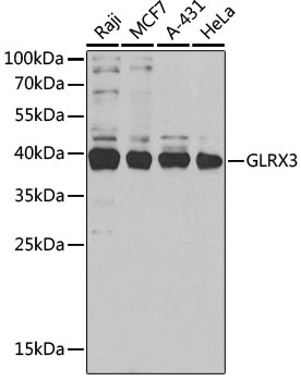 WB analysis of various sample lysates using GTX33564 TXNL2 antibody. Dilution : 1:1000 Loading : 25microg per lane