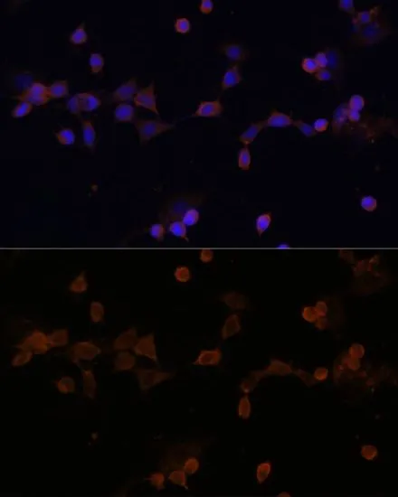 ICC/IF analysis of HeLa cells using GTX33568 UBE2L3 antibody. Blue : DAPI Dilution : 1:100