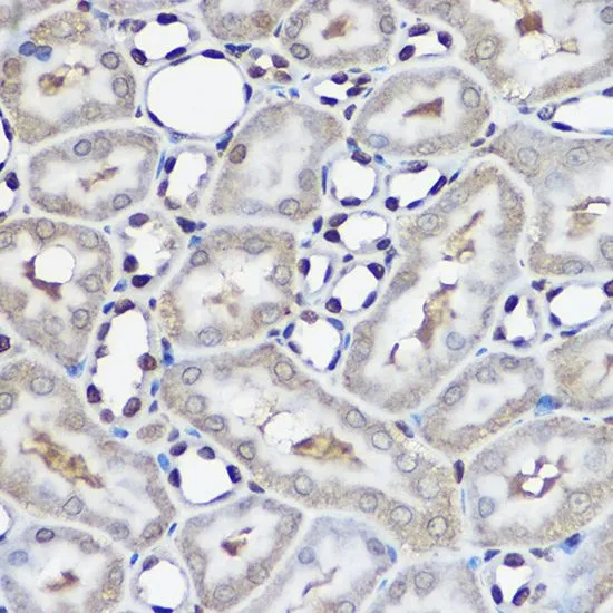 IHC-P analysis of human stomach tissue using GTX33568 UBE2L3 antibody. Dilution : 1:100