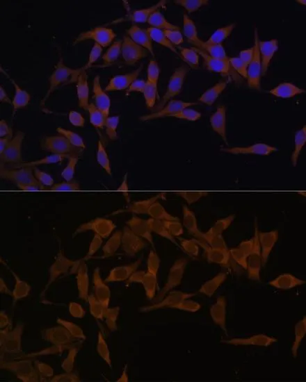 IHC-P analysis of mouse brain tissue using GTX33568 UBE2L3 antibody. Dilution : 1:100