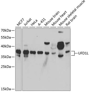 WB analysis of various sample lysates using GTX33570 UFD1L antibody. Dilution : 1:1000 Loading : 25microg per lane WB analysis of various sample lysates using GTX33570 UFD1L antibody. Dilution : 1:1000 Loading : 25microg per lane