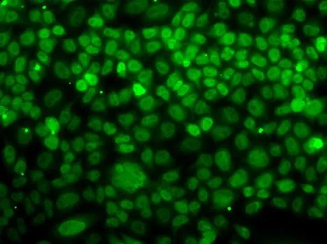 ICC/IF analysis of MCF7 cells using GTX33570 UFD1L antibody.