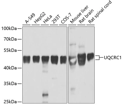 WB analysis of various sample lysates using GTX33572 UQCRC1 antibody. Dilution : 1:1000 Loading : 25microg per lane WB analysis of various sample lysates using GTX33572 UQCRC1 antibody. Dilution : 1:1000 Loading : 25microg per lane