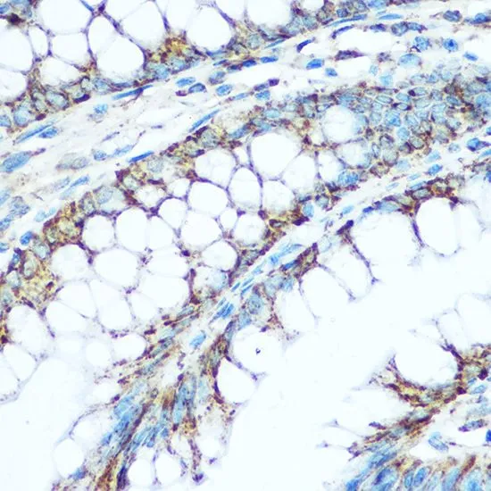 IHC-P analysis of human colon tissue using GTX33572 UQCRC1 antibody. Dilution : 1:100
