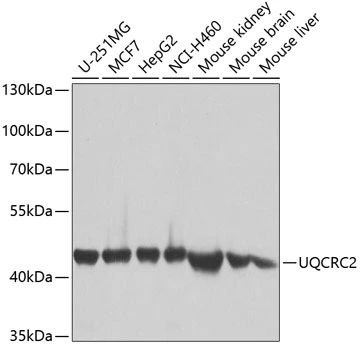 WB analysis of various sample lysates using GTX33573 UQCRC2 antibody. Dilution : 1:1000 Loading : 25microg per lane