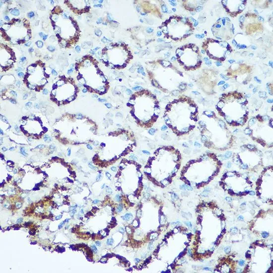 IHC-P analysis of rat kidney tissue using GTX33573 UQCRC2 antibody. Dilution : 1:100