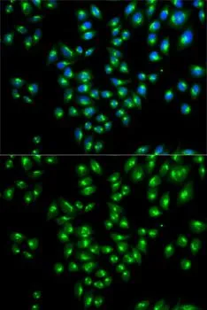 ICC/IF analysis of HeLa cells using GTX33578 VDP / p115 antibody. Blue : DAPI