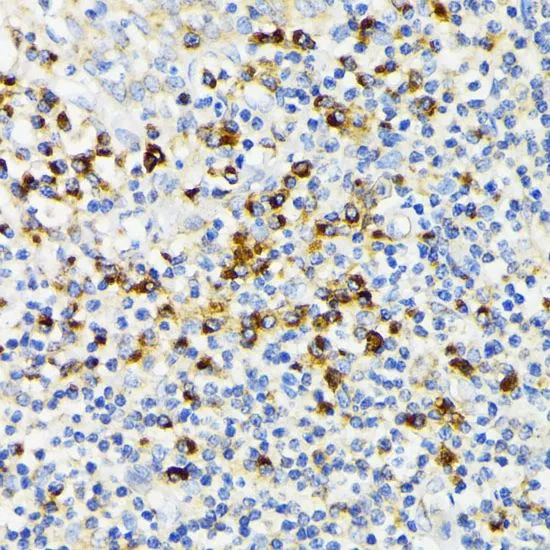 IHC-P analysis of human tonsil tissue using GTX33578 VDP / p115 antibody. Dilution : 1:100