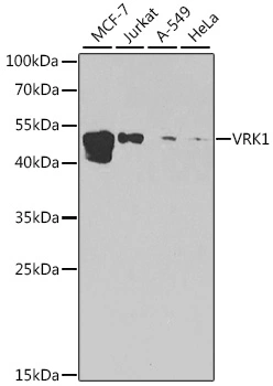 WB analysis of various sample lysates using GTX33581 VRK1 antibody. The signal was developed with ECL plus-Enhanced. Dilution : 1:1000 Loading : 25microg per lane WB analysis of various sample lysates using GTX33581 VRK1 antibody. The signal was developed with ECL plus-Enhanced. Dilution : 1:1000 Loading : 25microg per lane