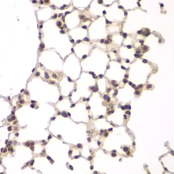 IHC-P analysis of rat lung tissue using GTX33581 VRK1 antibody. Dilution : 1:100