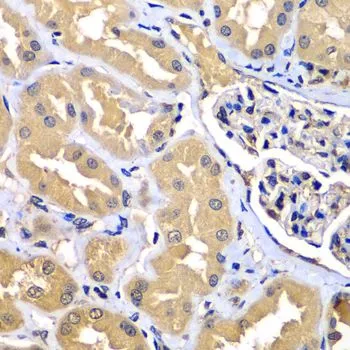 IHC-P analysis of human kidney tissue using GTX33584 WIPI2 antibody. Dilution : 1:100