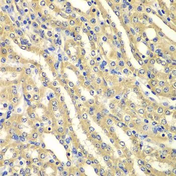 IHC-P analysis of mouse kidney tissue using GTX33584 WIPI2 antibody. Dilution : 1:100