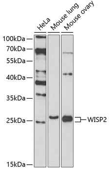 WB analysis of various sample lysates using GTX33585 WISP2 antibody. The signal was developed with ECL plus-Enhanced. Dilution : 1:1000 Loading : 25microg per lane WB analysis of various sample lysates using GTX33585 WISP2 antibody. The signal was developed with ECL plus-Enhanced. Dilution : 1:1000 Loading : 25microg per lane