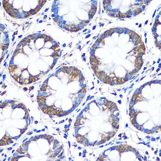 IHC-P analysis of human colon tissue using GTX33585 WISP2 antibody. Dilution : 1:100