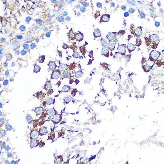 IHC-P analysis of rat testis tissue using GTX33585 WISP2 antibody. Dilution : 1:100