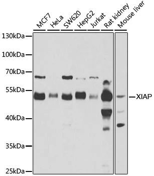 WB analysis of various sample lysates using GTX33586 XIAP antibody. Dilution : 1:1000 Loading : 25microg per lane