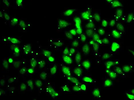 ICC/IF analysis of MCF7 cells using GTX33586 XIAP antibody.
