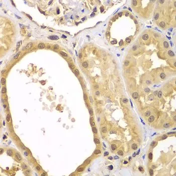 IHC-P analysis of human kidney tissue using GTX33586 XIAP antibody. Dilution : 1:100