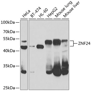 WB analysis of various sample lysates using GTX33590 ZNF24 antibody. The signal was developed with ECL plus-Enhanced. Dilution : 1:1000 Loading : 25microg per lane WB analysis of various sample lysates using GTX33590 ZNF24 antibody. The signal was developed with ECL plus-Enhanced. Dilution : 1:1000 Loading : 25microg per lane