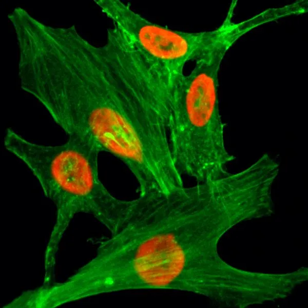 ICC/IF analysis of HeLa cells treated with sodium butyrate using GTX33591 Histone H2A.Z (Acetyl Lys4) antibody [RM221]. Red : Primary antibody Green : Actin
