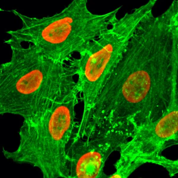ICC/IF analysis of HeLa cells treated with sodium butyrate using GTX33593 Histone H2B (Acetyl Lys20) antibody [RM235]. Red : Primary antibody Green : Actin