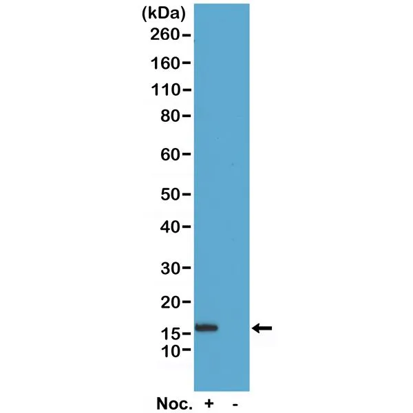 WB analysis of acid extracts of HeLa cells treated or non-treated with Nocodazole using GTX33598 Histone H2B (phospho Ser14) antibody [RM238]. Dilution : 0.5microg/ml