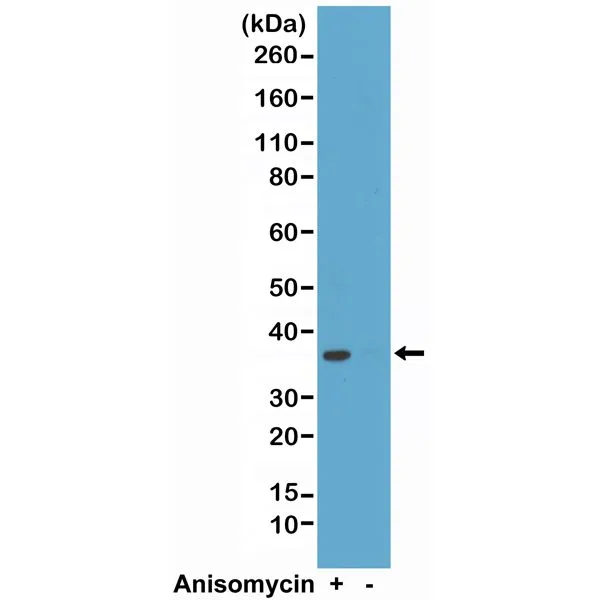 WB analysis of HeLa cell treated or non-treated with anisomycin lysates using GTX33599 p38 MAPK (phospho Thr180/Tyr182) antibody [RM243]. Dilution : 1:1000