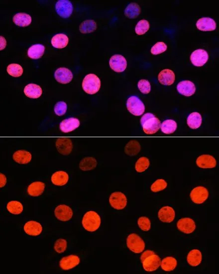 ICC/IF analysis of NIH/3T3 cells using GTX33905 Histone H3R2me2 (Symmetric Di-methyl Arg2) antibody. Blue : DAPI Dilution : 1:100