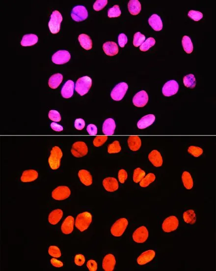 ICC/IF analysis of U2OS cells using GTX33905 Histone H3R2me2 (Symmetric Di-methyl Arg2) antibody. Blue : DAPI Dilution : 1:100