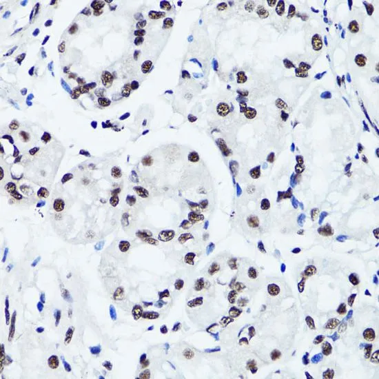 IHC-P analysis of human stomach tissue using GTX33905 Histone H3R2me2 (Symmetric Di-methyl Arg2) antibody. Dilution : 1:100