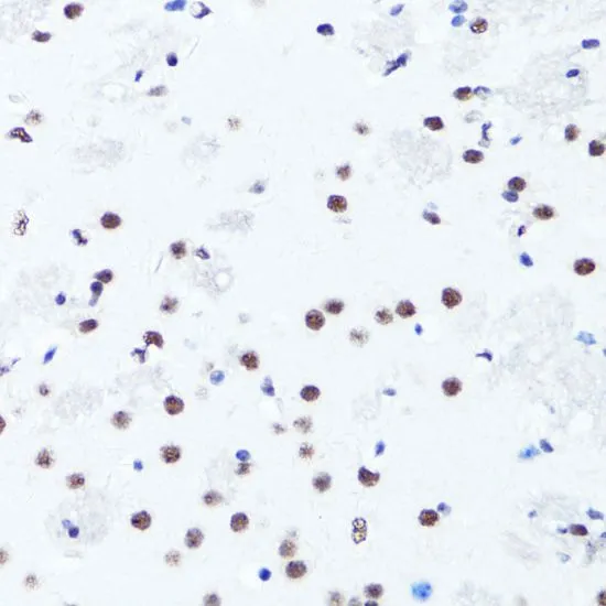 IHC-P analysis of mouse brain tissue using GTX33905 Histone H3R2me2 (Symmetric Di-methyl Arg2) antibody. Dilution : 1:100