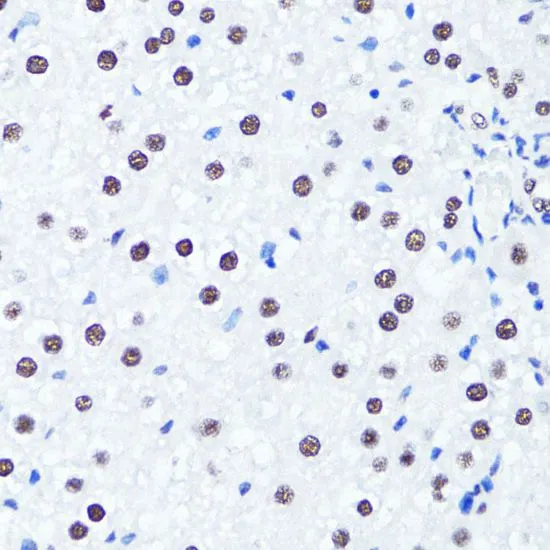 IHC-P analysis of rat liver tissue using GTX33905 Histone H3R2me2 (Symmetric Di-methyl Arg2) antibody. Dilution : 1:100